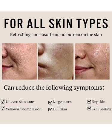 Rice Ceramide Toner Toner for Face Skincare Toner with Niacinamide Hydrating Toner Deep Moisturiser Very Moisturizing Essential Toner Containing Rice Extract Natural - Buy Online on GoSupps.com