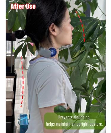 Adjustable Neck Support Brace Rotation Neck Stretcher Exerciser Improving Forward Neck Posture with Versatile Physical Traction at Home - Buy Online on GoSupps.com