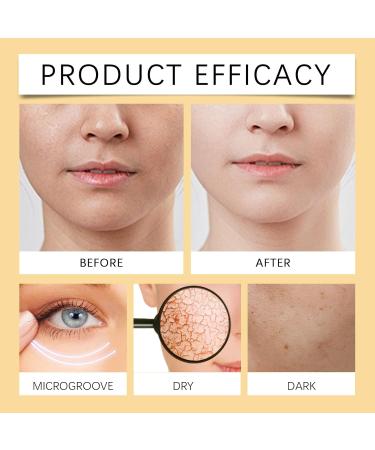 Gentle Hydrating Facial Cleanser - Deep Pore Cleansing Oil Control Moisturizing & Skin Repairing Face Wash For Acne Blackhead & Whitehead Treatment(1PCS) 1 Count (Pack of 1) - Buy Online on GoSupps.com