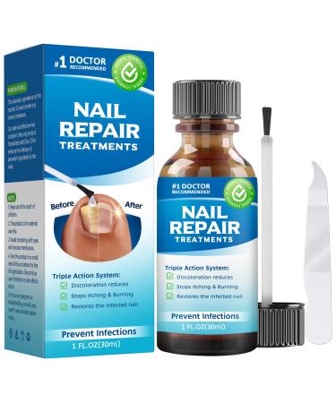 Nail Repair  Nail Repair for Damaged Nails  Renew Cracked & Discolored Toenail  Natural Solution for Nail Problems and Relieving Nail Pain 1.fl.oz