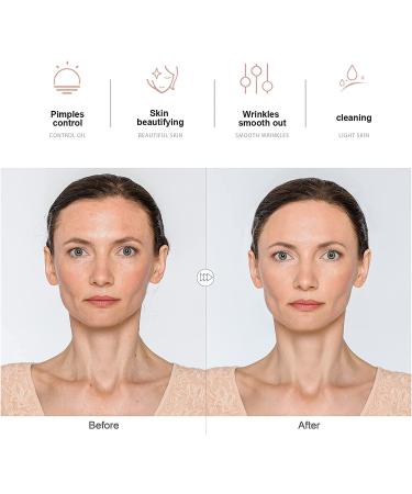 NewWay High Frequency Therapy Wand Machine with 4 Argon | Skin Tightening, Hair Follicle Stimulation, Facial Beauty Treatment - Buy Online on GoSupps.com