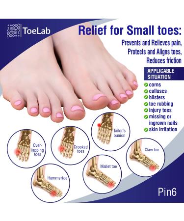 ToeLab Pinky Toe Separators and Splint Set - 6 Pieces for Baby Toe Cushioning and Straightening - Buy Online on GoSupps.com