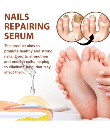 7 Days Nail Growth Serum Set - Repair & Strengthening Cuticle Oil for Damaged Nails - Buy Online on GoSupps.com