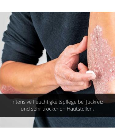 Naturprodukte Schwarz NeuroPsori Cream - Special Care for Psoriasis & Neurodermatitis 250ml | International Shipping Available - Buy Online on GoSupps.com