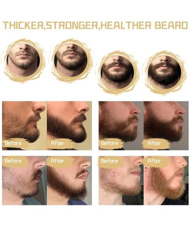 Beard Growth Kit for Men - Beard Roller, Growth Oil, Balm, Comb, Scissors - Birthday Father's Gift - Buy Online on GoSupps.com