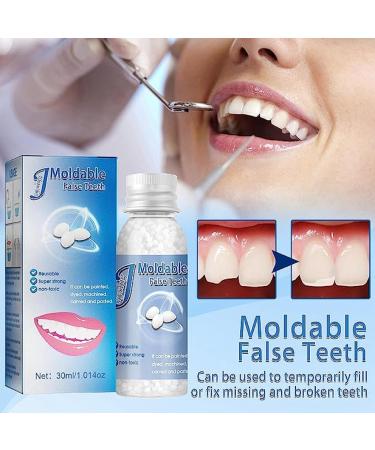 Temporary Tooth Repair Kit - Dental Glue for Fixing Missing Teeth - Buy Online on GoSupps.com