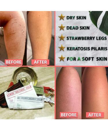 Kelebek Turkish Hammam Kese | Premium Exfoliating Glove for Body | Dead Skin Cleanser & Scrub | Skincare Kit for Soft Skin | Men & Women - Buy Online on GoSupps.com