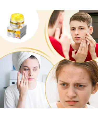  Generisch Skin moisturizer facial moisturizer skin repair cream facial moisturizers | Facial moisturizer - Buy Online on GoSupps.com