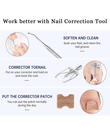 Fitmedify Ingrown Toenail Corrector Kit - Nail Patches for Ingrown Toenail Treatment and Removal - Buy Online on GoSupps.com