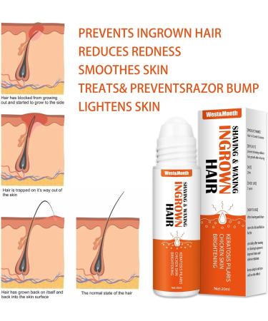 Mombiy Burns & Shave Bump Solution - Care for Ingrown Hair & Skin Irritation | White Unit Size - International Shipping Available - Buy Online on GoSupps.com