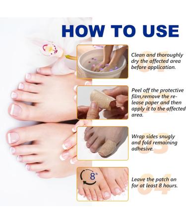Toenail Fungus Treatment Extra Strength | 32 Nighttime Fungal Nail Patches | Fast Results in 8 Hours - Buy Online on GoSupps.com