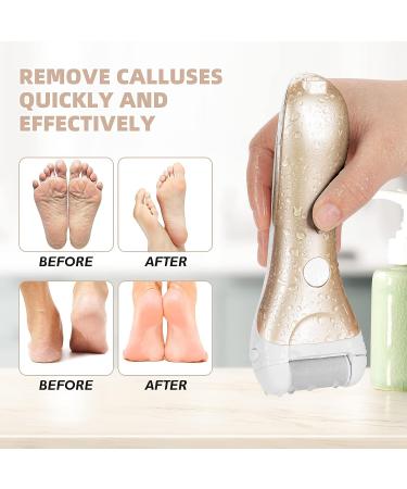 Nicebirdie Electric Callus Remover for Feet | Rechargeable & Waterproof Pedicure Tool for Cracked Heels & Dead Skin - Buy Online on GoSupps.com