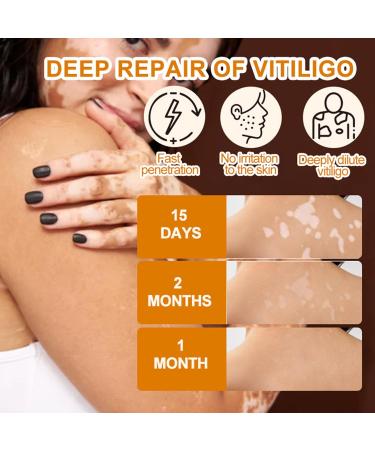Crsetmyth Vitiligo Care Cream Skin Lightening and Repair Treatment 50ml - Buy Online on GoSupps.com