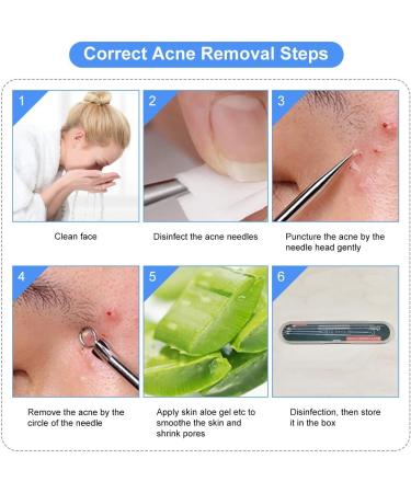 4PCS Blackhead Remover Tool Set for Acne, Comedone, Pimples, Spot, and Zit Extraction - Buy Online on GoSupps.com
