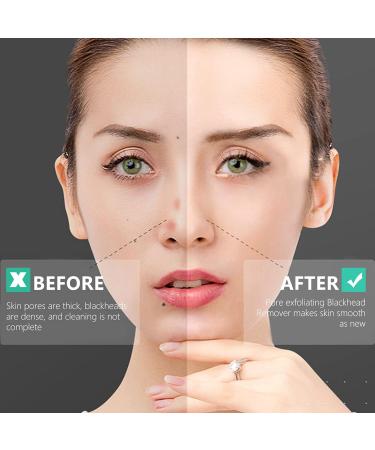 Premium Multi-Functional Cleansing Brush - Manual Face Wash & Durable Facial Brush - Buy Online on GoSupps.com