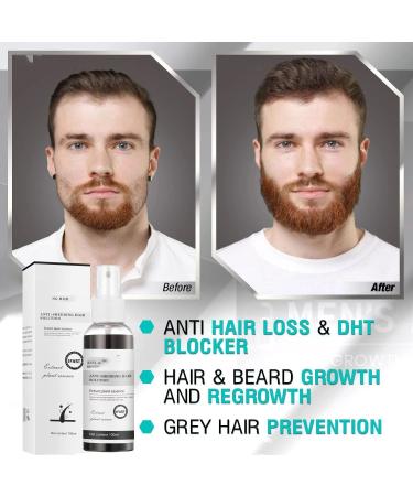  EXQST Blusoms Hair Loss Gel Blusoms Master Natural Herbal Liquid Hair Loss Gel - Buy Online on GoSupps.com