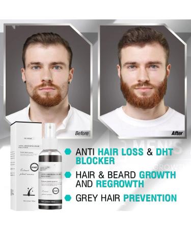 Blusoms Natural Herbal Hair Growth Essence Oils | Revitalize & Nourish Your Hair | Fast International Shipping - Buy Online on GoSupps.com