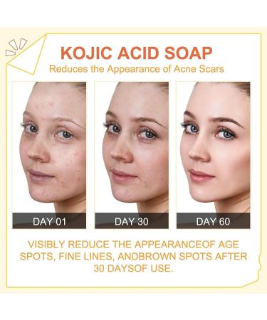 2 x 65G Peak Light Kojic Acid Skin Lightning Soap Face Bar - Targets Dark Spots, Acne, and Red Scars - Highest Grade Formula - Buy Online on GoSupps.com