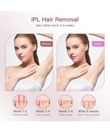 IPL Hair Removal Device with Ice Function | Unlimited Flash & 3 Modes | Effective Laser for Body Face Armpits & Bikini - A-Rosa White - Buy Online on GoSupps.com