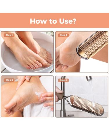 Professional Foot File Scrubber Pedicure - Callus Remover for Feet | Easkep Foot Grater Rasp Scraper for Corns and Dead Skin (Golden) - Buy Online on GoSupps.com