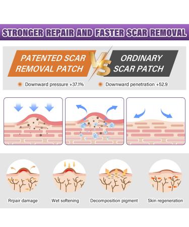 Silicone Scar Sheets & Tape | Effective Scar Removal for Surgical & Keloid Scars - 1.6 x 59 Roll (1.5M) - Fast International Shipping - Buy Online on GoSupps.com