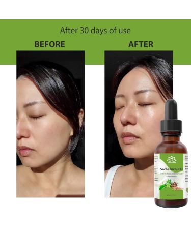 Relaxcation Cold Pressed Sacha Inchi Oil - Pure Unrefined Virgin Oil from Peru | Natural Carrier Extract for Face Hair and Body | 100% Plant-Based (4 oz) 4 Fl Oz (Pack of 1) - Buy Online on GoSupps.com