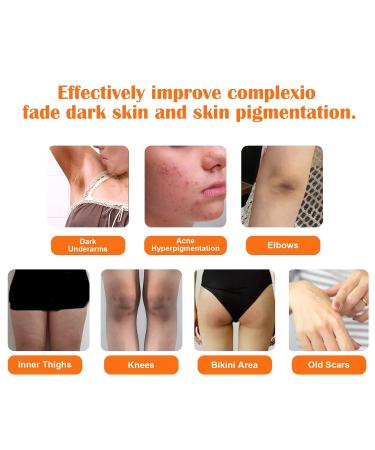 Poleview Kojic Acid Skin Lightening Soap - 2 Bars, 100g - Brightens Skin, Evens Tone, Reduces Hyperpigmentation - Buy Online on GoSupps.com