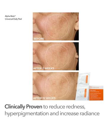 Dr Dennis Gross dpl FaceWare Pro LED Device Boost Collagen Brighten & Firm Kit Pink LED Mask Cleansing Oil Dewy Deep Cream & 5 Universal Daily Peels | $592 Value Gift Set - Buy Online on GoSupps.com