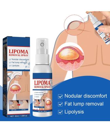 Lipoma Removal Spray Lipoma Reduction Anti-cellulite Body Shaper Spray for Men and Women 50ml - Buy Online on GoSupps.com