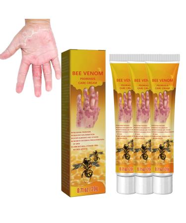 Youth Bee Venom Psoriasis Treatment Cream New Zealand Bee Venom Professional Psoriasis Treatment Cream for All Skin Types Soothing and Moisturizing (Color : 3pcs)