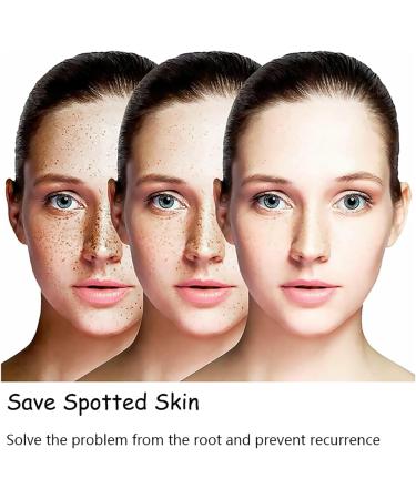 Aobenz Serum | Aobenz Whitening and Freckle Removing Essence | Aobenz Anti-Spot Serum Aobenz Spot Remover Serum Aobenz Dark Spot Correcting Serum Brightening and Removing Freckles (2Pcs) - Buy Online on GoSupps.com