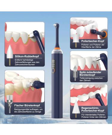 Buy Hassokon Tooth Whitening Set - Effective Tooth Bleaching & Polishing - International Shipping Available - Buy Online on GoSupps.com