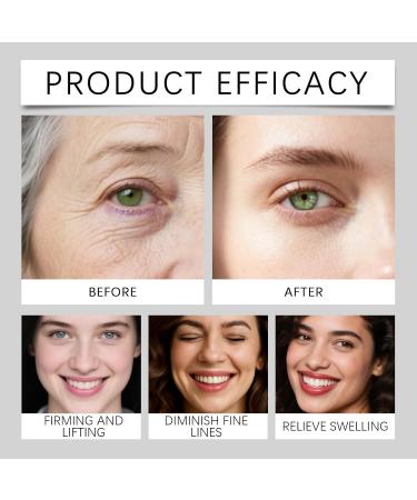  Nuvilo Retinol eye cream with hyaluronic acid under-eye care for dark circles puffiness and fine lines anti-aging wrinkle cream firming and moisturizing treatment for women & men (4 pcs) - Buy Online on GoSupps.com