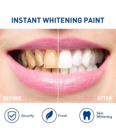 Teeth Whitening Pen (2 Packs) Natural Gel Treatment - Safe, Effective, Painless Whitener - Removes Years of Stains - Travel-Friendly - Buy Online on GoSupps.com