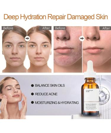 Retinol 1% In Squalane 30ml Retinol Serum for Face & Hyaluronic Acid Serum for Face Anti Aging Serum for Face Brightening Face Serum for Women Reduce Fine Lines Wrinkles Vegan Skincare - Buy Online on GoSupps.com