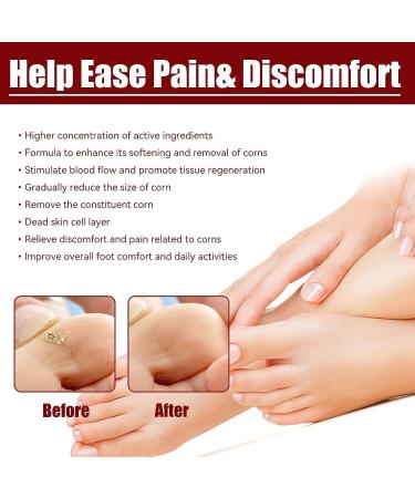 Extra Strength Foot Corn Removal Gel 10ml - Skin Smoothing & Repairing - Pack of 5 - Buy Online on GoSupps.com