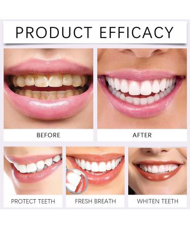 Gum Repair Gel Teeth Whitening Essence Gum Whitening Gel Teeth Repair Essence Pen for Gums Safe Protect (1pcs) - Buy Online on GoSupps.com