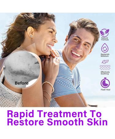Azelaic Acid Serum Cream Azelaic Acid 12% Facial Serum Hydrating Serum with Vitamin C for Acne Redness Dark Spot Anti Aging Serum for Face Face Skin Care Beauty Brightening Serum for All Skin Types - Buy Online on GoSupps.com