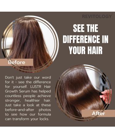 Hair Growth Serum with Rosemary Oil | Ultra Light Non-Greasy Formula for Daily Use | Enhance Hair Reduce Frizz & Thinning - Buy Online on GoSupps.com