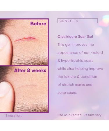 Scar Ointment & Gel | Effective Stretch Mark Removal | Scar Cream for Post-Surgery Care - Buy Online on GoSupps.com