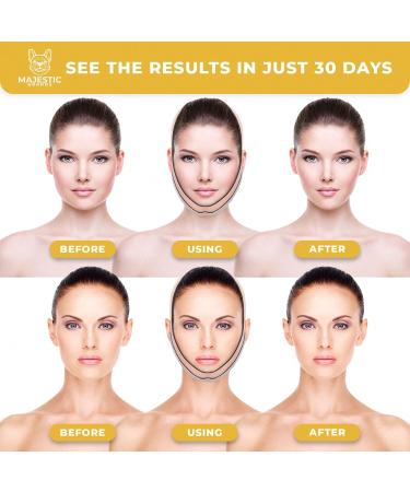 Face Slimming Strap for Women & Men - Tighten and Sculpt Lower Jaw Support - V Line Face Jaw and Chin Support Strap Breathable Material With Packaging - Buy Online on GoSupps.com