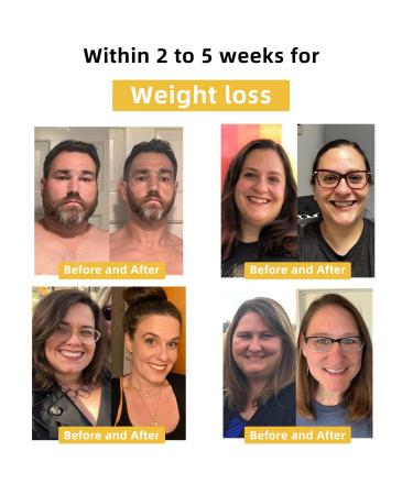 STDEI Bee Venom Intestinal Drops - All Skin Care for Men & Women 20ml | Shop Internationally - Buy Online on GoSupps.com