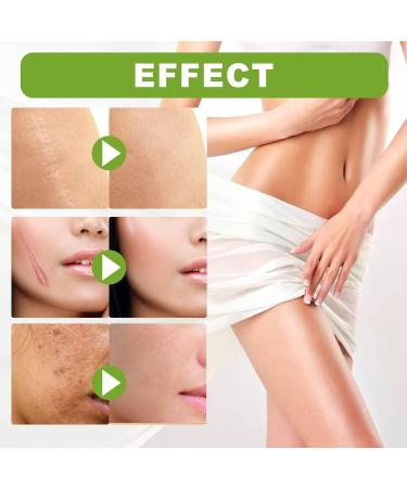 Essence r paratrice de cicatrices avanc e naturelle s rum r parateur de cicatrices de qualit m dicale r pare et lisse la peau pour tous types de cicatrices 1Pcs - Buy Online on GoSupps.com
