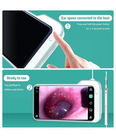 Otoscope Ear Wax Removal Kit 3.9mm HP 5 Inch Screen Digital Otoscope Handheld Visual Ear Cleaning Scope Endoscope Ear Scope for Adults Kids &Pets Green - Buy Online on GoSupps.com