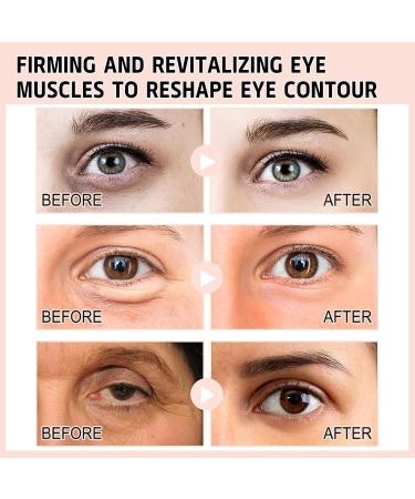 Retinol Eye Serum Eye Cream for Dark Circles and Puffy Eyes Anti Aging Eye Bag Removal Fade Fine Line Wrinkle Reduce Crow Feet Suitable for All Type - Buy Online on GoSupps.com