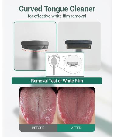 DEARCUS Korean Tongue Scraper - 3 Replaceable Heads BPA Free TPE Reduces Bad Breath Hygienic & Modern Design - Buy Internationally - Buy Online on GoSupps.com