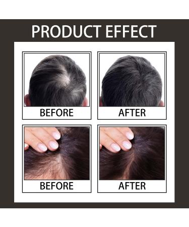 Hair Fibers for Thinning Hair - Long-Lasting Waterproof Touch Up Powder for All Hair Types (Black - Buy Online on GoSupps.com