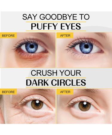 MOKYDUO 24K Gold Collagen Eye Patches for Dark Circles & Puffiness - 30 Pairs | Anti-Wrinkle, Moisturizing Eye Mask for Women - Buy Online on GoSupps.com