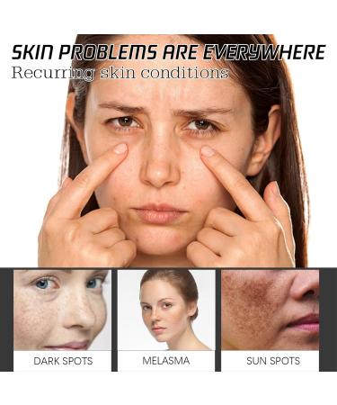 Face Serum for Women - Niacinamide Serum - Face Serum - Dark Spot Correcting Glow serum - Hydrating Serum - Bee Venom Face Care Brightening Serum Blackhead Remover Skincare - Buy Online on GoSupps.com