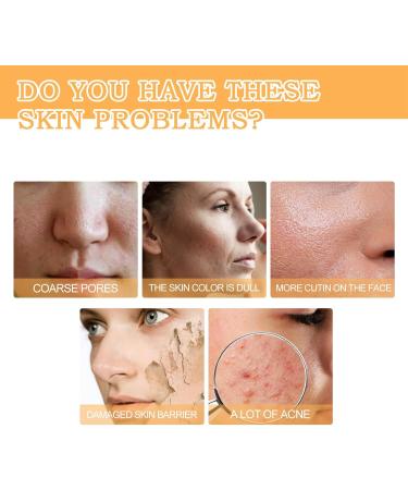 Glycolic Acid 7% Toning Resurfacing Solution - Glycolic Sour 7% Toner - Hydrating Toning Solution - Skincare Hyaluronic Acid Serum - for Blemishes and Acne Prevents Skin Aging Strengthen Your Skin - Buy Online on GoSupps.com